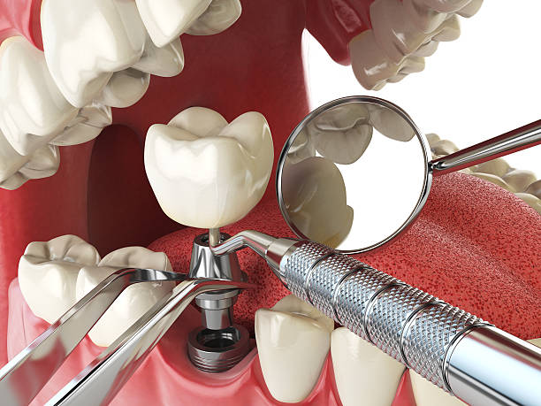 Best Emergency Broken Tooth Repair in Hawthorn Woods, IL